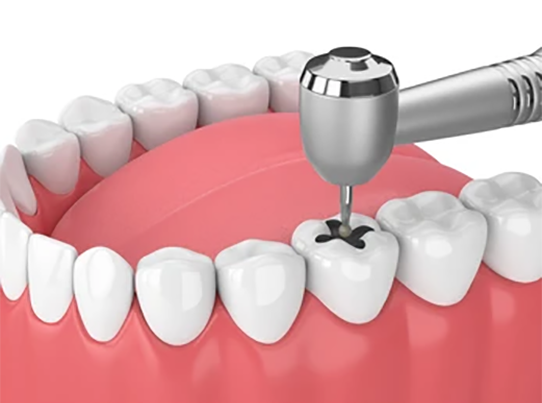 3d-render-jaw-teeth-dental-260nw-1283409181